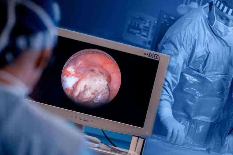 Эндоурология